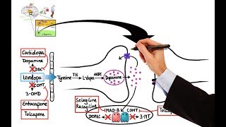 Parkinsons disease  an Osmosis Preview [upl. by Einaoj]