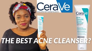 Cerave Acne Foaming Cream Cleanser Review  Dr Janet [upl. by Eiznekam]