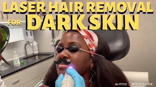 Getting Laser Hair Removal on Dark Skin Cutera 1064 Laser [upl. by Araminta]