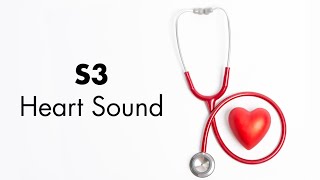 S3 Heart Sound  MEDZCOOL [upl. by Acinyt616]