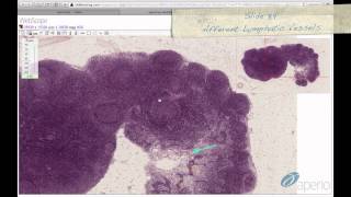 Histology Helper  Lymphoid Tissue Histology [upl. by Oralie]