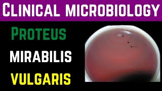 Proteus Mirabilis amp Vulgaris ClinicalPathogenesisInvestigationTreatmentPrevention  Dr Mubashar [upl. by Gnohp]