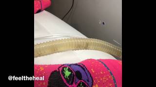 Live Colonic Irrigation Detox [upl. by Willett105]