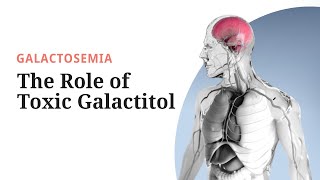 Celiac Disease amp Gluten Sensitivity Risk Factors Pathogenesis Symptoms Diagnosis Treatment [upl. by Harihat]