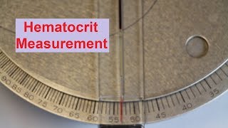 Hematocrit Measurement [upl. by Pell]