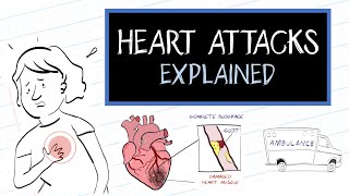 British Heart Foundation  What is a Heart Attack [upl. by Ttemme374]