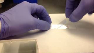 Hematology Making a Peripheral Blood Smear [upl. by Yereffej]