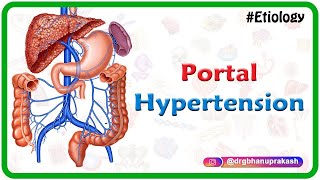 Portal hypertension USMLE Step 1  Etiology Clinical features Diagnosis and Treatment [upl. by Aray327]