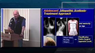 Decision Making in Adult Spinal Deformity [upl. by Cassy]