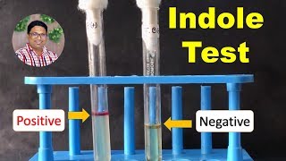 Bacterial Identification Tests Indole Test [upl. by Trebuh]