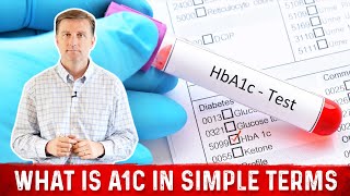 What is A1C in Simple Terms – Dr Berg [upl. by Haelat]