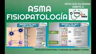 ASMA BRONQUIAL FISIOPATOLOGÍA  GuiaMed [upl. by Adnwahsat197]