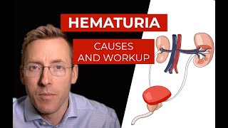 Hematuria causes and evaluation of blood in your urine [upl. by Eiznil]