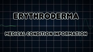 Erythroderma Medical Condition [upl. by Rozek218]