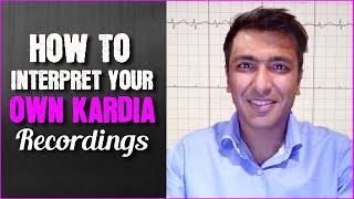 How to interpret your own Kardia recordings [upl. by Yecies]