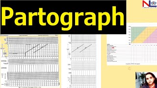 Partograph plotting  Nursing Lecture [upl. by Menon]