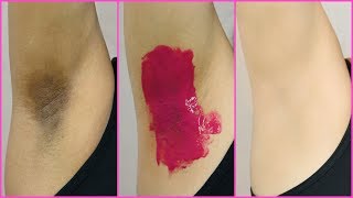 How To Lighten Dark Underarms PERMANENTLY  100 Naturally  Anaysa [upl. by Gnal]