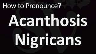 How to Pronounce Acanthosis Nigricans CORRECTLY [upl. by Boyes]