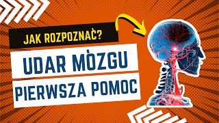 Udar mózgu pierwsza pomoc🚨 udar [upl. by Gigi]