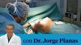 ¿Los implantes de senos son para toda la vida [upl. by Acirfa]