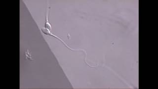 Sperm swimming in microscope field [upl. by Zach705]