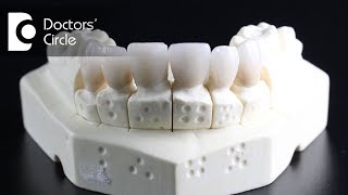 What are the options of tooth replacement after permanent tooth extraction  Dr M R Pujari [upl. by Anital990]