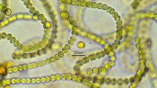 Nostoc commune  the nitrogen fixing cyanobacterium [upl. by Aeht]