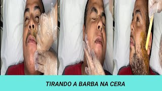 DEPILANDO A BARBA COM CERA ELÁSTICA  parte 1 [upl. by Ahsirtap]