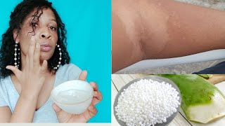 Recipe How to make an exfoliating urea and aloe vera Gel [upl. by Mota]