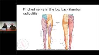 Bulging discs Causes Symptoms and Treatment Options [upl. by Geer901]