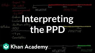 Interpreting the PPD  Infectious diseases  NCLEXRN  Khan Academy [upl. by Ettennat]