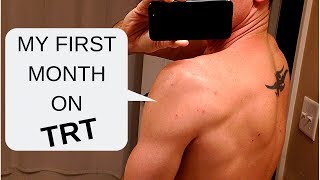 My First Month on TRT  Testosterone Replacement Therapy [upl. by Wilser354]