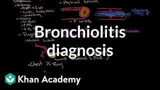 Bronchitis Symptoms Causes Treatments  Dr MyHuyen Tran [upl. by Kcirddet]