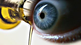 Does Castor Oil Help with Cataracts [upl. by Qidas531]