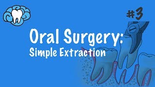 Oral Surgery  Simple Extraction  INBDE ADAT [upl. by Atiuqes]