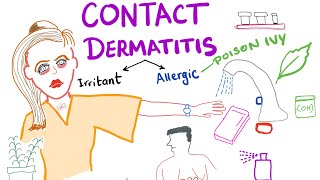 Contact Dermatitis [upl. by Notgnimer]