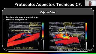 Doppler Arterias Carótidas y Vertebrales  Dr Daniel Sandoval Guerra [upl. by Loveridge]