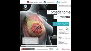 FIBROADENOMA DE MAMA [upl. by Beaston]