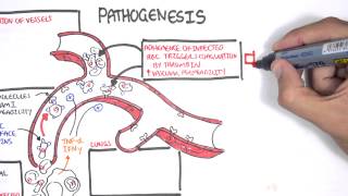 Malaria Pathophysiology [upl. by Neeloj837]