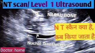 40 Weeks In The Womb by Ultrasound Dimensions [upl. by Nissensohn]