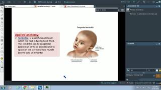 Posterior Triangle of Neck amp Sternomastoid Muscle  Dr Ahmed Farid [upl. by Inimak493]