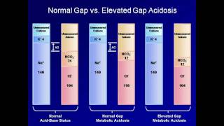 ABG Interpretation The Anion Gap Lesson 5 [upl. by Cloris]