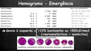 Avaliação rápida do hemograma [upl. by Asehr]