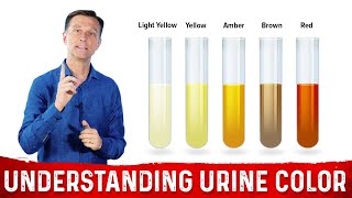 What Urine Color Indicates About Your Body – DrBerg [upl. by Bach181]