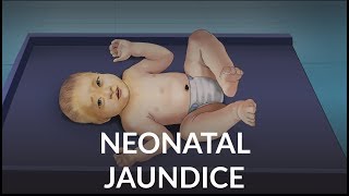 Neonatal Jaundice by L Veit  OPENPediatrics [upl. by Sidnal773]