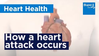 What is a Heart Attack HealthSketch [upl. by Iffar]