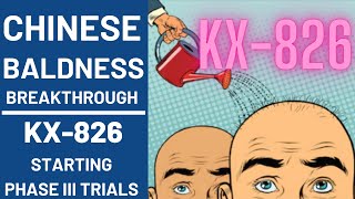 Chinese KX826 Baldness BREAKTHROUGH [upl. by Anaillil770]