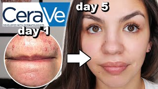 I Used CeraVe Skincare For One Week [upl. by Zebulon409]