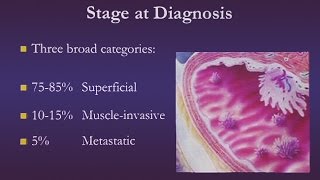 Bladder Cancer [upl. by Tharp]