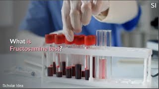 What is Fructosamine test [upl. by Hippel]